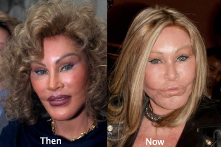 12 Most Expensive Celebrity Plastic Surgeries Ever and How Much They Cost