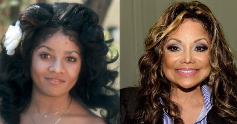 10 Celebrity Plastic Surgery Disasters You Need To See