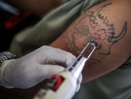 Cara Menghilangkan Tato Permanen dengan Aman, Jangan Asal Coba Biar Kulit Tetap Sehat